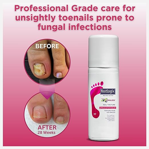 Footlogix Nail Tincture Spray with Spiraleen 1.7fl oz.