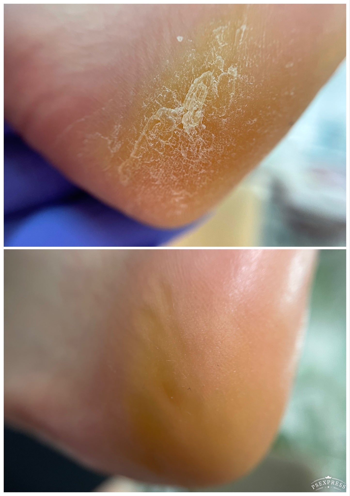 Level 2. Russian Pedicure ADVANCED/Footlogix 1 Day Class